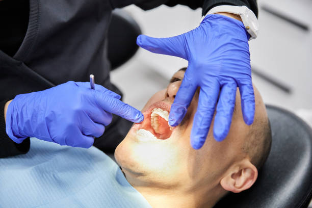 Best Emergency Dental Care for Broken or Chipped Teeth in Dixon, IL